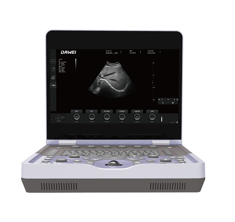 "Yunhai" ultrasound operating platform