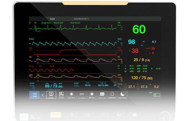 Full-View 1280x800 HD display