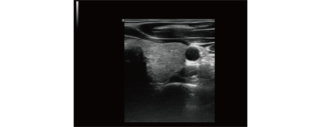 Spatial compound imaging technology