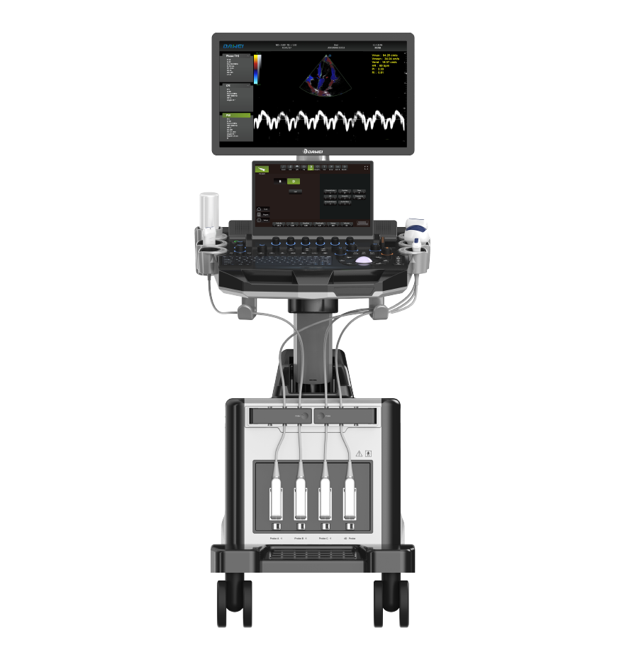 High-End trolley Color Ultrasound for Versatile Applications